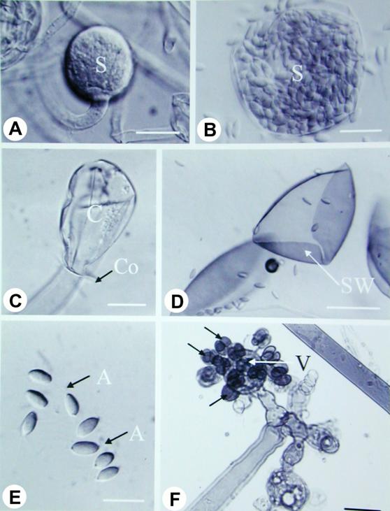 Blakeslea trispora. A-K. LM (DIC). A. A circinate sporangiophore with a  terminal developing sporangium (S). Bar = 20 µm; B. A mature sporangium (S) with many spores inside. Bar = 20 µm; C. Columella (C) with collar (Co). Bar = 20 µm; D. A dehiscent sporangial wall (SW) after liberation of the sporangiospores. Bar = 50 µm; E. Liberated sporangiospores from sporangium illustrating longitudinal striations and appendages (A). Bar = 20 µm; F. Apex of the sporangiophore illustrating irregular successive constrictions and the terminal spherical vesicles (V) with some sporangiola (arrows) still attached on the surface. Bar = 20 µm; G. The terminal spherical vesicles (V) after sporangiola detached, showing small spherical pedicels (P) over the surface. Bar = 20 µm; H. A three-spored sporangiolum with its pedicel (arrow) still attached. Bar = 20 µm; I. A breaking, empty sporangiolum wall (arrow) and the pedicel. Bar = 20 µm; J. Liberated sporangiospores illustrating longitudinal striations. Bar = 20 µm; K. Zygospore with tongs-shaped suspensors (arrow). Bar = 20 µm. 