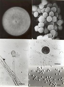 Morphology of Mucor circinelloides f. janssenii BCRC 32496. A. Colony grown on MEA medium at 20°C for 7 days. B. Sporangiospores (Bar= 3 μm). C. Sporangiophore with columella (Bar= 30 μm). D. Sporangium (Bar= 30 μm). E. Sporangiospores (Bar= 10 μm). 