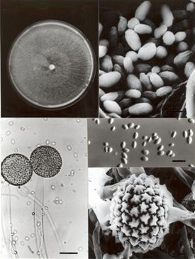 Morphology of Mucor genevensis BCRC 32471. A. Colony grown on MEA medium at 20°C for 7 days. B. Sporangiospores (Bar= 3 μm). C. Sporangia (Bar= 30 μm). D. Sporangiospores (Bar= 10 μm). E. Zygospore (Bar= 10 μm). 