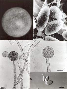 Morphology of Mucor recurvus var. recurvus BCRC 32483. A. Colony grown on MEA medium at 20°C for 7 days. B. Sporagniospores (Bar= 3 μm). C. Sporangium 9 (Bar= 30 μm). D. Sporagiophore with columella (Bar= 30 μm). E. Sporagiospores (Bar= 10 μm). 