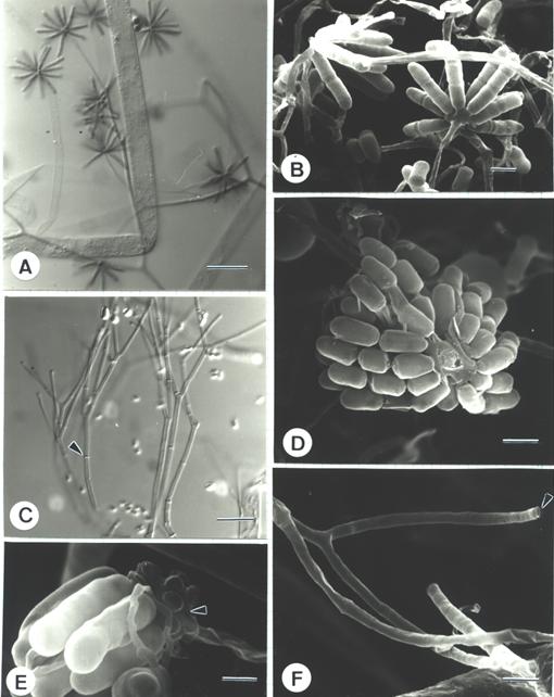 Piptocephalis fimbriata. A, C, LM (DIC); B, D-F, SEM. A. Upper portion of a sporophore showing the branching pattern and the merosporangia on tips. Bar = 20 μm. B. Nearly mature merosporangia on the tip of sporophore. Bar = 2.5 μm. C. Portion of aged sporophores with septa (arrow head) formed. Bar = 20 μm. D. Ellipsoidal, cylindrical merosporangiospores. Bar = 2 μm. E. Young merosporangia born on a head cell (arrow head). Bar = 3.0 μm. F. Terminal portion of ultimate branch showing fringe on tip (Arrow head). Bar = 2.5 μm. 
