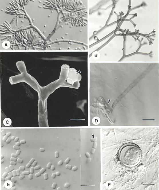 Piptocephalis indica. A, B, D-F, LM; C, SEM. A. Upper portion of a young sporangiophore showing the branching pattern; B. Upper portion of a sporangiophore after the merosporangia detached; C. Terminal dichotomous branch of a sporangiophore after the head cell detached. Note the detached, lobed head cell (arrow head); D. Rhizoid on the base of the sporangiophore; E. Spores and head cells (Arrow head); F. Zygospore. Bars = 20 μm for A-D, F; Bar = 2.5 μm for C; Bar = 10 μm for E. 
