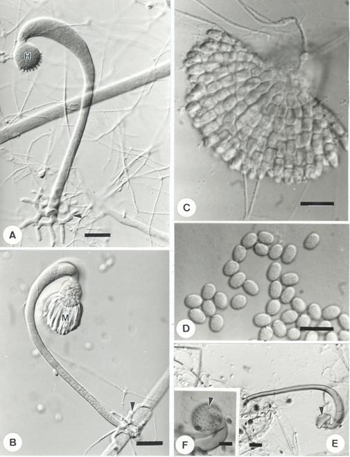 Syncephalis cornu. A-F, LM (ICT). A. Sporangiophore with head (H) bearing merosporangial primordia, note the stout and branching rhizoid (arrow head); B. Sporangiophore with young merosporangia (M) on the head, note the rhizoid (arrow head) anchoring the host hyphae; C. Merosporangia fragmented into spores; D. Spores with fine spines on the surface; E. Sporangiophore with collapsed head (arrow head); F. Fertile head with warts (arrow head) after merosporangia detached. Bars = 20 μm for A, B, E; Bars = 10 μm for C, D, F. 