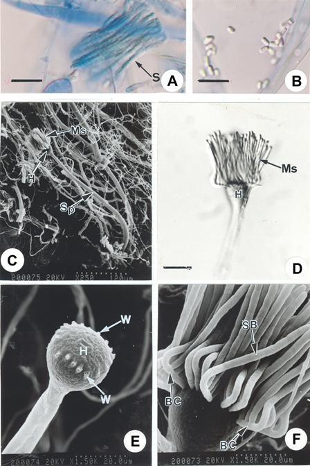 Syncephalis depressa. A, B, D, LM; .C, E, F, SEM. A. Meroporangia frangmentated into cylindrical spores (S). (Stained with cotton blue). Bar = 20 μm; B. Cylindrical spores. Bar = 20 μm; C. Tapering sporangiophore (Sp) with head (H) and young merosporangium (Ms); D. Merosporangium (Ms) forming on top of the funnel shaped head (H ). Bar = 20 μm; E. Warts (W) left on top of head (H) after merosporangia fallen off; F. Basal cell (BC)with sporangiferous baranches (SB). 
