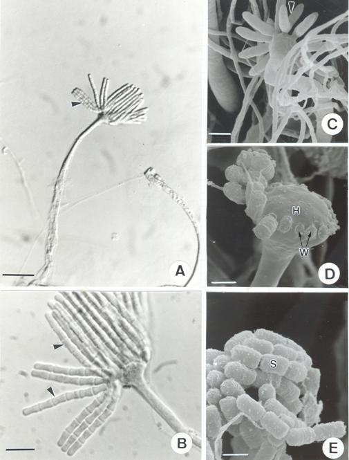 Syncephalis obconica. A-B, LM (Normaski); C-E, SEM. A. Sporophore with head and merosporangia (Arrow head) on head. Bar = 20 μm; B. Enlargement of the head of sporophore shown in A. showing the articulated merosporangia (arrow head ). Bar = 10 μm; C. Bottom view of a head bearing dihotomously branched young merosporangia (Arrow head). Bar = 10 μm; D. Fertile head (H) with warts (W) left after merosporangia detached. Bar = 4 μm; E. Cylindrical merospores (S). Bar = 5 μm. 