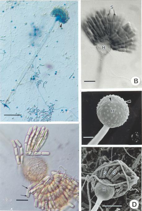 Syncephalis sphaerica. A, B, E, LM (Normaski); C-D, SEM. A. Sporophore with head and merosporangia (arrow head) (Stained with cotton blue). Bar = 50 µm; B. Fragmented merospores (S) on head (H). Bar = 20 µm; C. Fertile head (H) with warts (arrow heads) left after merosporangia detached. Bar = 15 µm; D. Fragmented merospores (S) on head (H). Bar = 38 µm; E. Mature and detached merosporangiospores, note the refractive bodies (arrows) on both ends of the spore. Bar = 20 µm. 