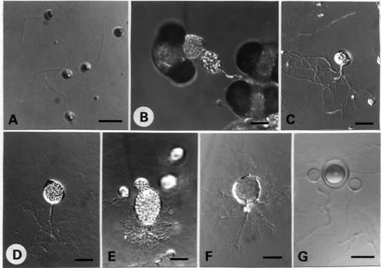 Rhizidium windermerense. A, uniflagellate zoospores; B, on pine pollen, epibiotic and interbiotic sporangium; C, young sporangium; D, mature sporangium with a subapical papilla; E, vesicular zoospores releasing; F, an empty sporangium; G, resting spore between two empty contributing thalli. (Bar = 10 μm in A & G; 20 μm in B-F) 