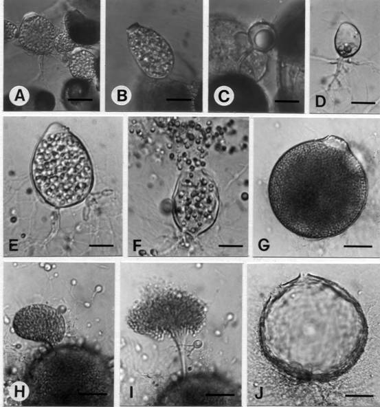 Rhizophlyctis mastigotrichis. A & B, interbiotic and epibiotic sporangia among pine pollen; C, interbiotic resting spore; D, young sporangium; E, in 1/4YpSs slush, ovoid sporangium with two rhizoidal axes and apical exit papilla; F, discharging zoospores; G, on 1/4YpSs agar, spherical sporangium with an exit papilla; H & I, zoospores discharge; J, an empty sporangium with two discharge pores. (A-F. Bar = 10 μm, G-J. Bar = 30 μm) 