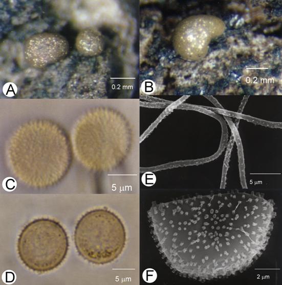 Calomyxa metallica. A. & B. Fruiting bodies, bar=0.2 mm; C & D. Spores, surface and marginal view, bar=5 μm; E. Capillitial threads, bar=5 μm; F. SEM of spores, collapsed, showing the surface markings, bar=2 μm. 