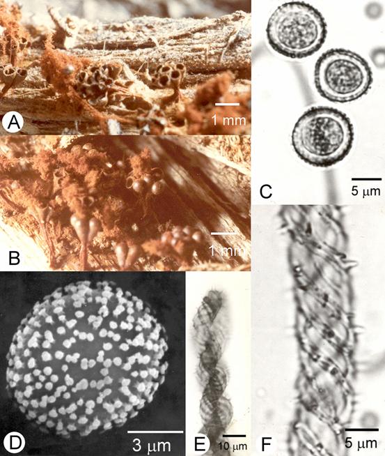 Metatrichia vesparium. A & B. Fruiting bodies, bar=1 mm; C. Spores, bar=5 μm; D. Spore, SEM, bar=3 μm; E & F. Capillitial threads, E, bar=10 μm; F, bar=5 μm. 