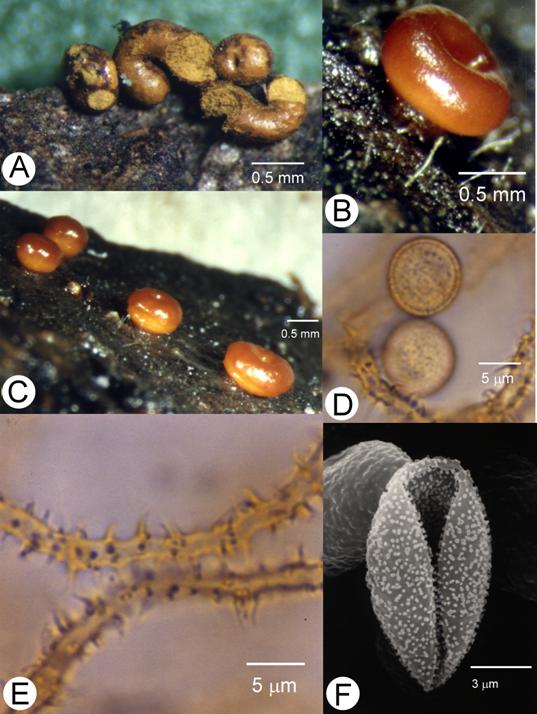 Perichaena chrysosperma. A-C. Fruiting bodies, bar=0.5 mm; D. Spores, bar=5 μm; E. Capillitial threads, bar=5 μm; F. Spore, SEM, bar=3 μm. 