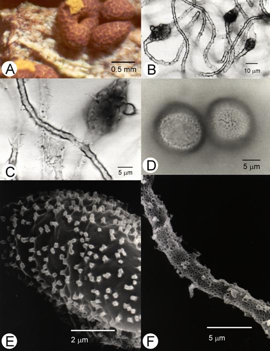 Perichaena corticalis. A. Fruiting bodies, bar=0.5mm; B. Capillitium, bar=10μm; C. Capillitial threads, bar=5μm; D. Spores, bar=5 μm; E. surface markings of spore, bar=2 μm; F. Capillitial thread, SEM, bar=5 μm. 