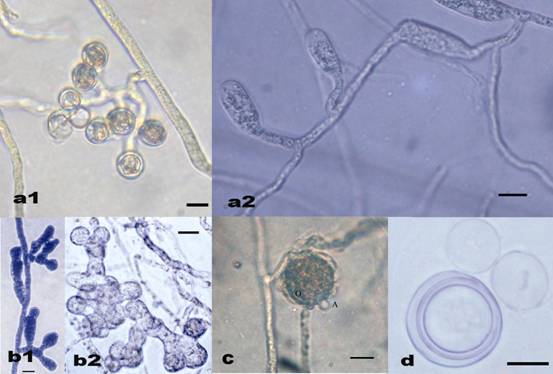 Pythium myriotylum. a1 & a2. appressoria, b1 & b2. sporangia, c. oogonium and antheridium, d. oospore. Bar=10 μm. 