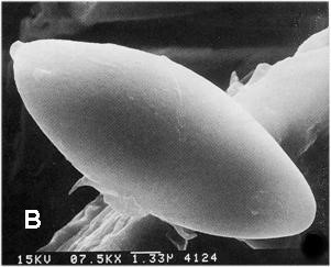 Boletellus projectellus. A. Basidiome. B. Scanning electron micrograph of basidiospore. C. Basidia; D. Pleurocystidia. 