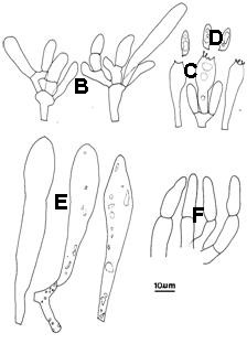 Fuscoboletinus ochraceoroseus. A. Basidiomes. B. Hymenium; C. Basidia; D. Basidiospores; E. Pleurocystidia; F. Caulocystidia. 