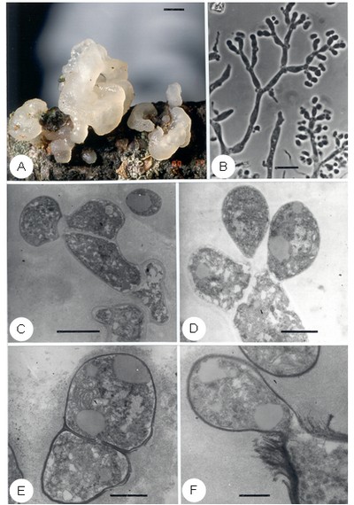Syzygospora nivalis. A. Gelatinous and gyrose basidiocarps, bar=0.5 cm. B. Conidiogenous cells and conidia, bar=10 μm. C. Fused zygoconidium, bar=2 μm. D. Two young individual conidia produced from conidiophore, bar=1 μm. E. Conidiophore, bar=1 μm. Note conidia detached and simple septal pore. F. Conidium, bar=0.5 μm. Note mononucleate conidiophorous cells and multilamellar scars. 