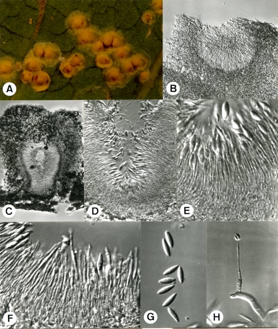Aschersonia suzukii. A. Stroma on infected homopteran whitefly host, 6X. B-C. Vertical section through stroma showing pycnidia, B. 120X, C. 83X. D. Pycnidium with sporulating structures and conidia, 360X. E-F. Conidiogenous cells, E. 980X, F. 1030X. G. Conidia, 870X. H. Associated conidiogenous cell and conidia of Hirsutella sp, 810X. 