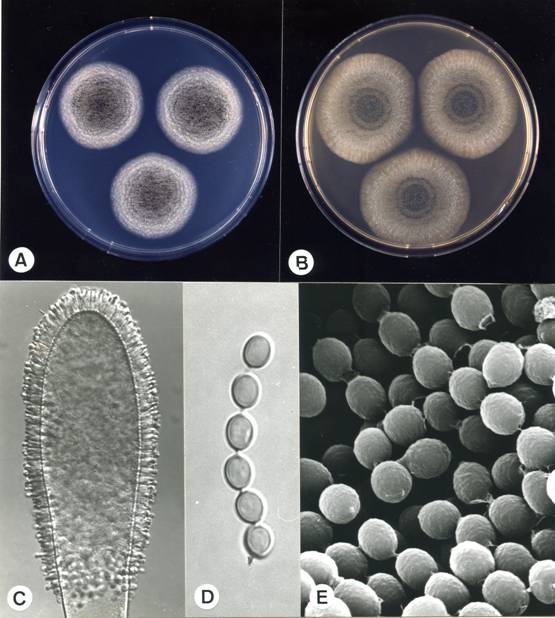 Aspergillus clavatus. A. colonies on CZ, 14 days, at 25°C; B. colonies on MEA, 14 days, at 25°C; C. aspergillum X410; D. conidia X2270; E. conidia (SEM) X6800. 