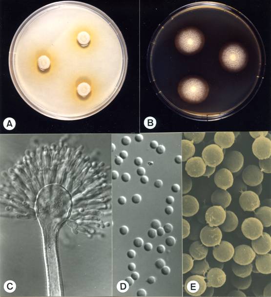 Aspergillus flavipes. A. colonies on CZ, 14 days, at 25°C; B. colonies on MEA, 14 days, at 25°C; C. aspergillum X1230; D. conidia X1745; E. conidia (SEM) X 