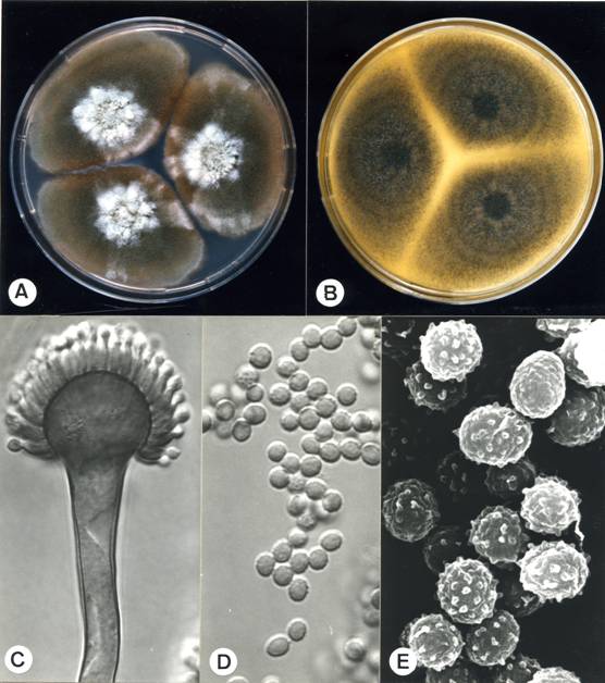 Aspergillus fumigatus. A. colonies on CZ, 14 days, at 25°C; B. colonies on MEA, 14 days, at 25°C; C. aspergillum X1470; D. conidia X2060; E. conidia (SEM) X15490. 