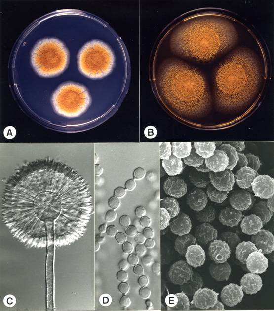 Aspergillus ostianus. A. colonies on CZ, 10 days, at 25°C; B. colonies on MEA, 10 days, at 25°C; C. aspergillum X310; D. conidia X1650; E. conidia X6660 (SEM). 