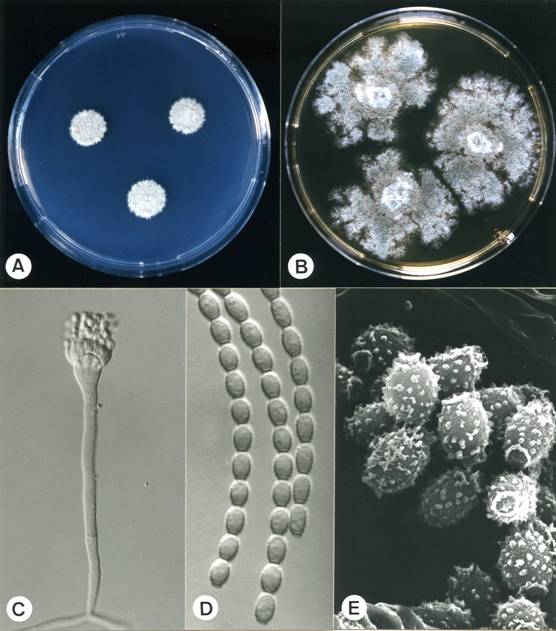 Aspergillus restrictus. A. colonies on CZ, 14 days, at 25°C; B. colonies on MEA, 14 days, at 25°C; C. aspergillum X775; D. conidia X1905; E. conidia (SEM) X15955. 