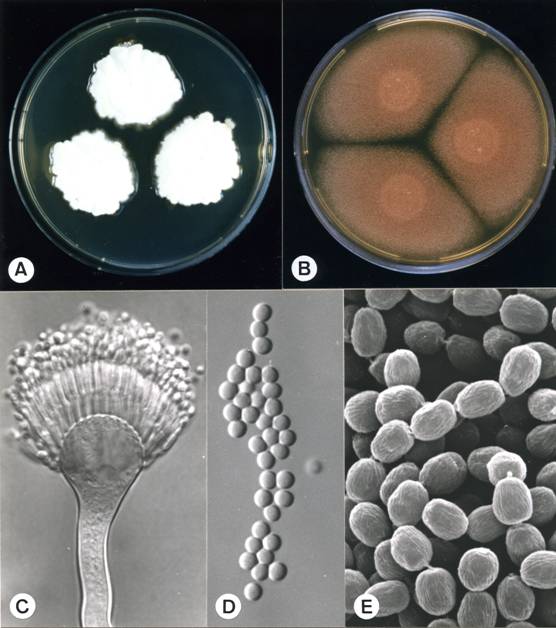 Aspergillus terreus. A. colonies on CZ, 10 days, at 25°C; B. colonies on MEA, 10 days, at 25°C; C. aspergillum X1210; D. conidia X2240; E. conidia (SEM) X16430. 