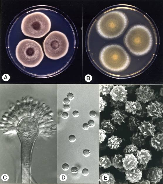 Aspergillus ustus. A. colonies on CZ, 10 days, at 25°C; B. colonies on MEA, 10 days, at 25°C; C. aspergillum X1240; D. conidia X2625; E. conidia (SEM) X12500. 