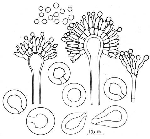 Aspergillus versicolor. Aspergilla, diminutive aspergillum, conidia, and Hulle cells. 