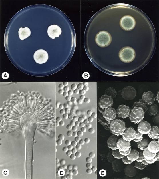 Aspergillus versicolor. A. colonies on CZ, 14 days, at 25°C; B. colonies on MEA, 14 days, at 25°C; C. aspergillum X1240; D. conidia X2020; E. conidia (SEM) X12350. 