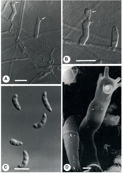 A-D. Dactylaria lunata. A. Conidiophores erect, cylindrical, straight or sinuous with terminal, cylindrical, sympodial denticles (arrows). B. Conidiophore bearing a conidium initial on one of its denticles (arrow). C. Conidia crescentic, containing distinct oil-droplets. D. Scanning electron micrograph depicting the sinuous, smooth-walled conidiophore, bearing at least 5 tubular flatended denticles, and a detached conidium with septum (arrow) and barely perceptible basal hilum (arrow). Bars in A-C, 10 μm, in D, 1 μm. 