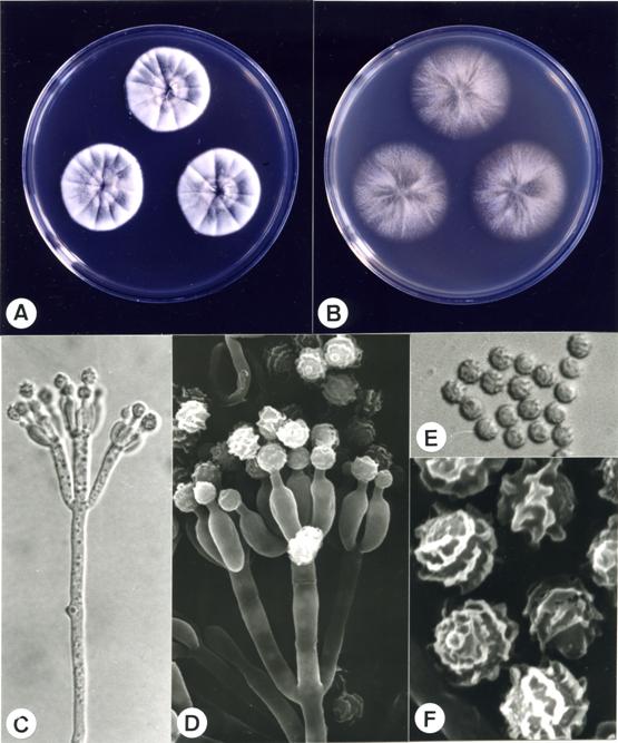 Penicillium daleae (CCRC 32392). A,B. colonies on CYA and MEA at 25°C, 7 days; C. penicillus X1650; D. penicillus X7000; E. conidia X2640; F. conidia X17600. 