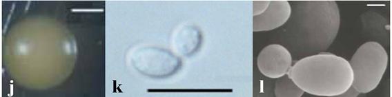 j-l, R. minuta. Bars = 1 mm (j, photographs by dissecting microscope); Bars = 10 μm (k, photographs by light microscope); Bars = 1 mm (l, photographs by SEM.) 