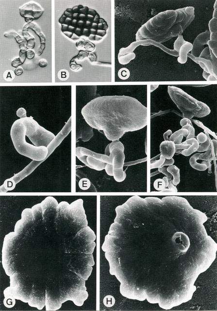 A-H. Turturconchata reticulata. Light (A-B) and SEM (C-H) of conidiophores, conidiogenous cells and conidia. A-B. Initiation and development of conidia from flexuous, coiled conidiogenous cells. C. Schizolytic secession of a mature conidium from the conidiogenous cells (arrow head). D. A cuneiform conidial mother cell initiated from curved conidiogenous cell (arrow head). E-F. Development of conidia. Note that sometimes the conidiogenous cells branch and become aggregated (arrow head). G-H. Surface and ventral view of the seceded conidia. Note the eccentric ventral pedicel (arrow head). Scale bars = 10 μm (A-B); 2 μm (C-H). 
