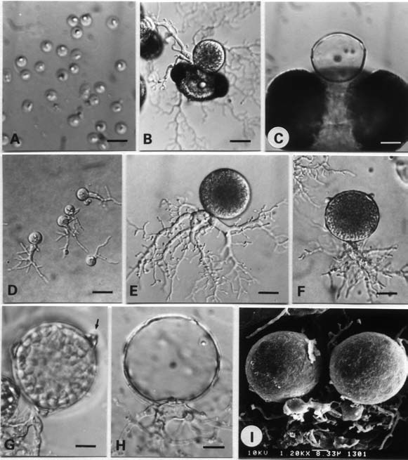 Spizellomyces pseudodichotomus. A. zoospores; B. interbiotic sporangium among pine pollen;C. on pine pollen, an empty sporangium; D and E. young sporangium; F. sporangium with three papillae; G. individual zoospore escapes from pore (arrow); H. an empty sporangium; I.two sporangia with bulbous apophysis. (Bar = 10 μm in A and C-H; 20 μm in B; 8.33 μm in I) 