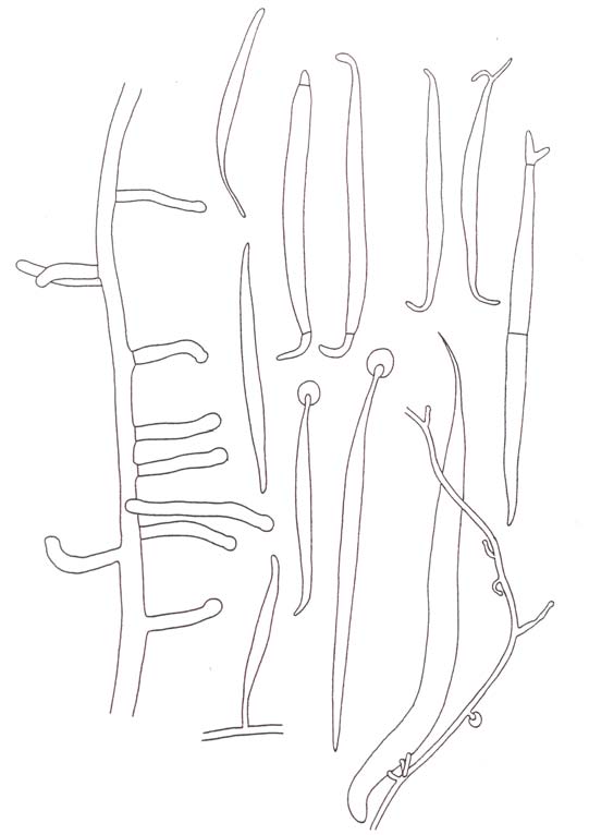 Acaulopage pectospora. Adhesive branches, captured nematodes and conidia. 