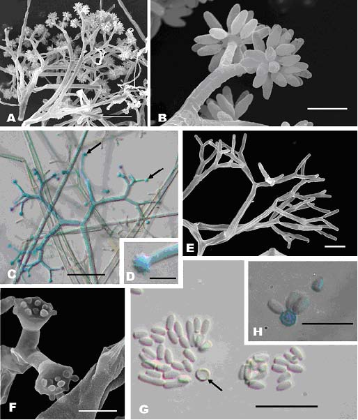 Piptocephalis tieghemiana. Figs. A, B, E, F, SEM; C, D, G, H, LM, DIC. A. Terminal portion of typical sporophore. Bar = 50.0 μm. B. Ultimate branches of a sporophore showing young merosporangia on head cells. Bar = 5.0 μm. C. Terminal enlargements (arrows) on ultimate branch. Bar = 20.0 μm. D. Head cell on ultimate branch. Bar = 5.0 μm. E. Terminal portion of sporophore after head cells detached. Bar = 10.0 μm. F. Two head cells on ultimate branch, depressions on top is caused by dehydration. Bar = 5.0 μm. G. Mature spores and head cell (arrow). Bar = 30.0 μm. H. Head cell with 3 spores attaching on the surface. Bar =30.0 um. 