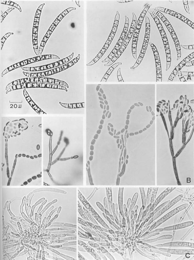 Fusarium decemcelluare (NCHU 3046). A. Macroconidia, B. Microconidia in chains & in false heads, C. Monophialides. 