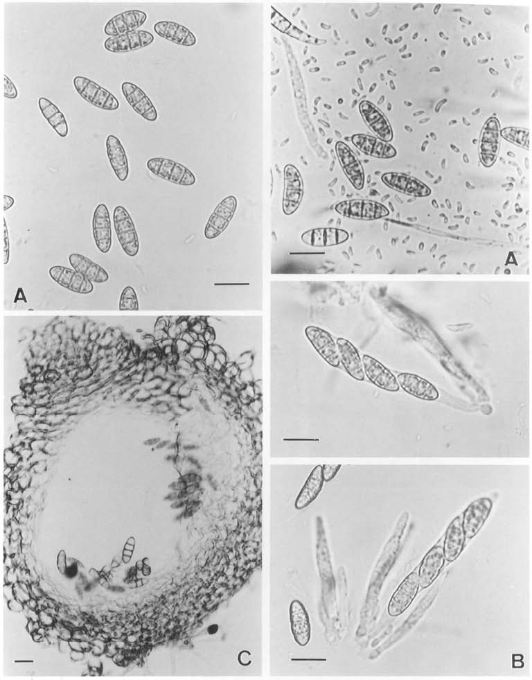 Nectria rigidiuscula A. ascospores & sperm-like spores, B. asci, C. perithecium. bars=20μm. 