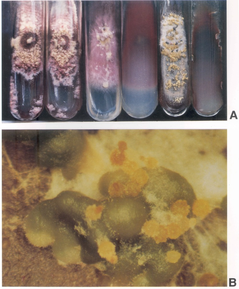 A. Fusarium decemcellulare；B. perithecia of Nectria rigidiuscula produced on potato dextrose agar. 