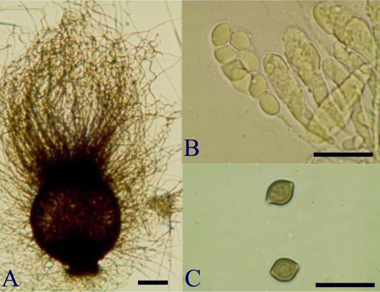 Chaetomium angustispirale. A. ascomata; B. asci with eight ascospores; C. ascospores. (A, bar = 100μm; B, C bar = 25μm) 