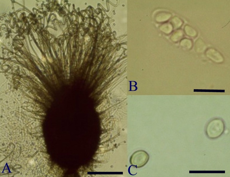 Chaetomium subspirale. A. ascomata; B. asccus with eight ascospores; C. ascospores. (A, bar = 67μm; B, C, bar =12.5μm) 