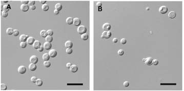 Morphology of Debaryomyces nepalensis SA10S05. A. cell morphology, 7days in GYP broth at 25℃. Bar = 10μm. B. Sporulation after 7 days in acetate agar at 18℃. Bar = 10μm. 