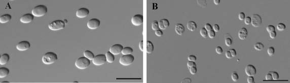 Morphology of Kazachstania wufongensis FN21S03T as determined by light microscopy. The strain was cultivated in YM broth for 3 days at 25°C (A). Ascospores produced on McClary’s acetate agar at 18 °C after one month (B). Scale bars = 10μm. 