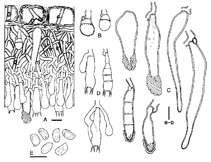 Hyphoderma subpraetermissum (holotype). A. Basidiocarp section. B. Stephanocysts. C. Cystidia. D. Basidia. E. Basidiospores. Scale bars = 10 μm. 