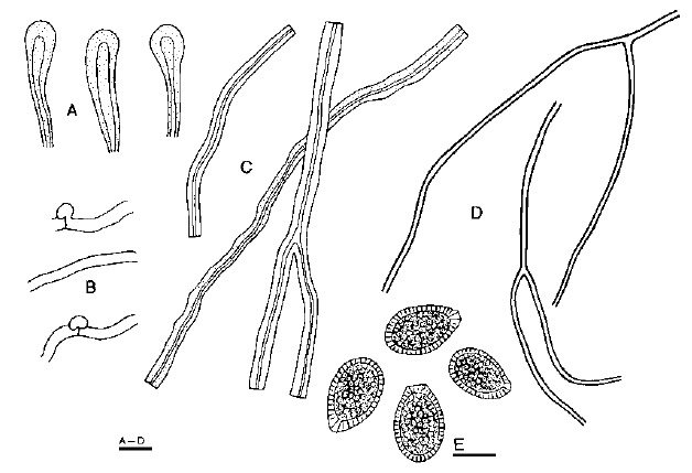 Tomophagus colossus (Wu 83-1). A. Apically swollen hyphal ends at pileus crust. B. Contextual generative hyphae. C. Contextual skeletal hyphae. D. Contextual binding hyphae. E. Basidiospores. Scale bars = 10 μm. 
