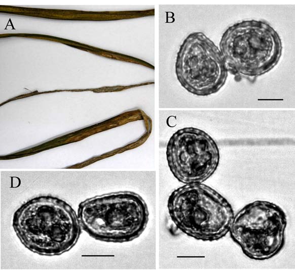 Puccinia hemerocallidis. A. The symptom of P. hemerocallidis on Hemerocallis fulva. B-D. Urediniospores. Bar=10μm 