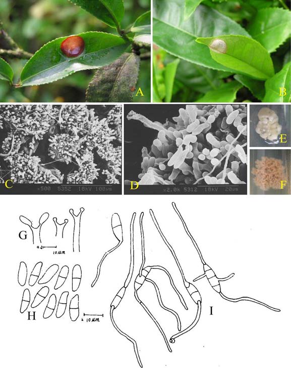 Exobasidium vexans on Camellia sinensis. A-B: symptom. C-D: basidia by SEM. E-F: colonies on PSA, E: 50 days, F: 6 months. G-I: draw-line of hymenium; G: basidia; H: basidiospores; I: germination of basidiospores. 