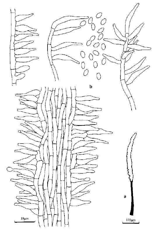 Akanthomycetes johnsonii. Synnema, septate conidiophores, phialidic conidiogenous cells and smooth-walled doliiform conidia. Scale bars: a = 100 μm. b = 10 μm. 