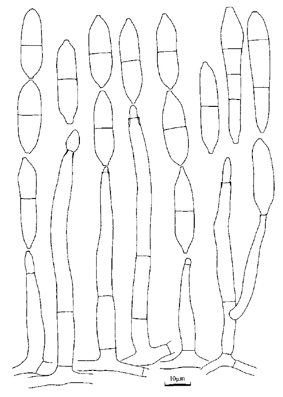 Antipodium arechae. conidiophores and conidia. 